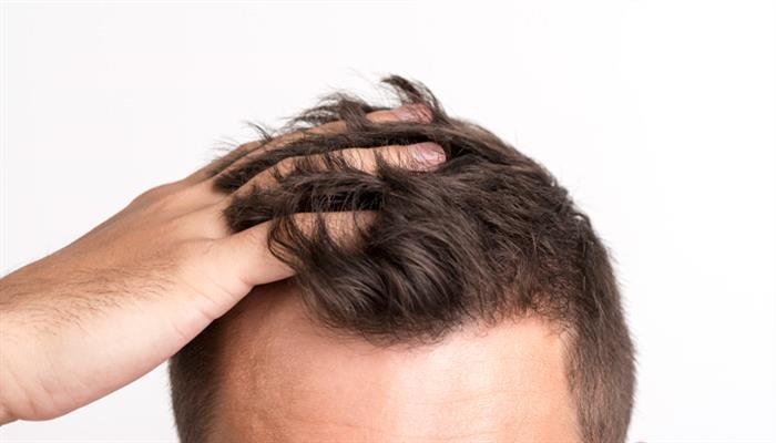 Yotta hat bald die Haare schön